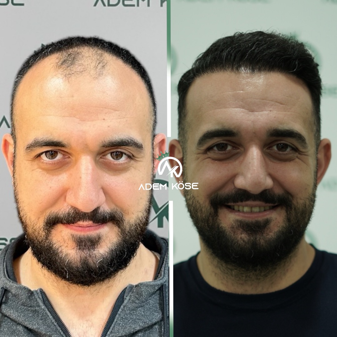 Özel Adem Köse Polikliniği